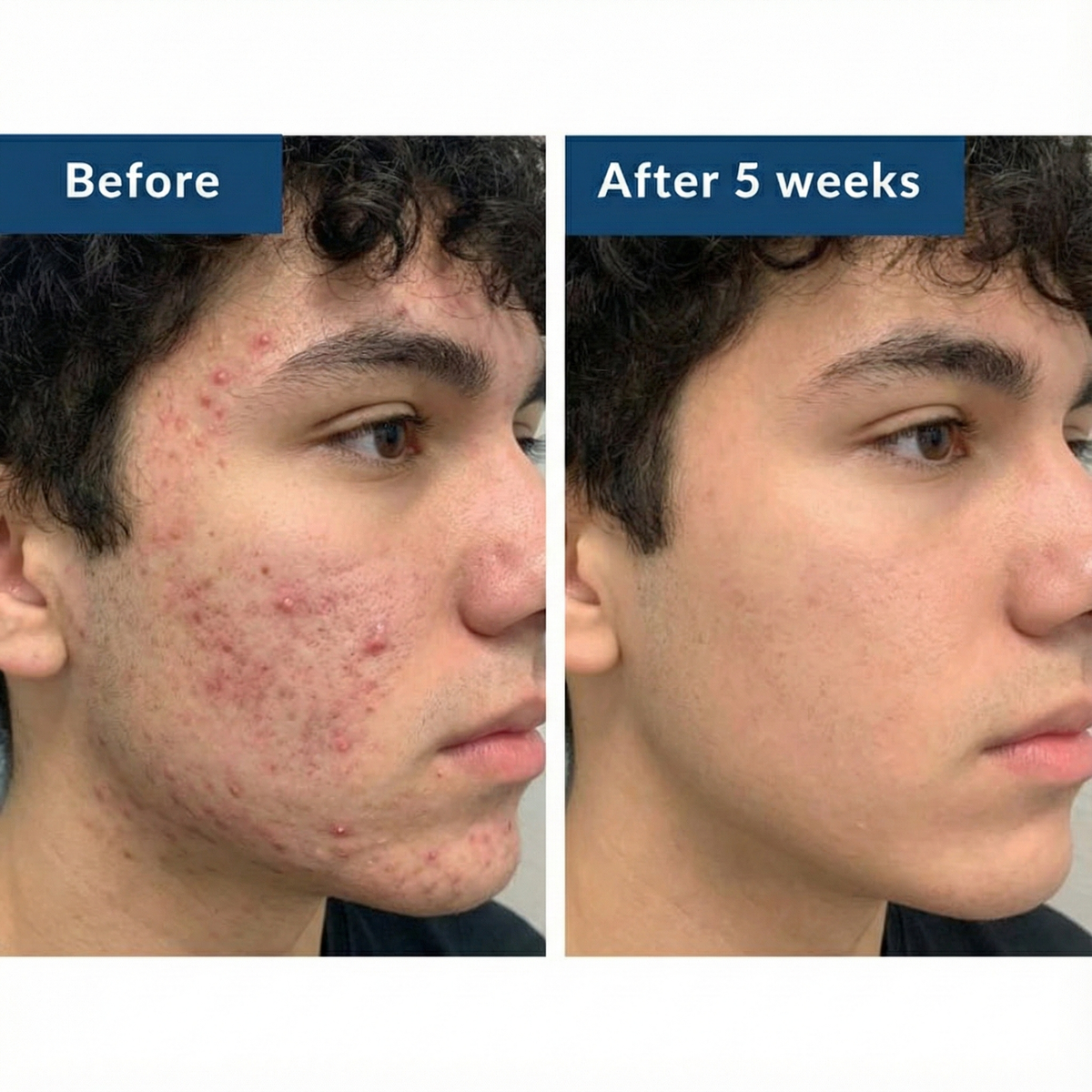 Thrive GHK-Cu Copper Peptide Serum – Skin Barrier Support & Hydration – 29ml